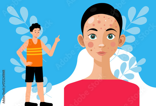 Hyperpigmentation Concept Illustration Vector Style