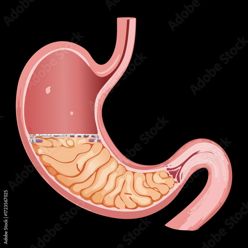 Visual Representation of the Stomach with Partially Digested Food Particles and Liquid Chyme Ready for Intestinal Passage	