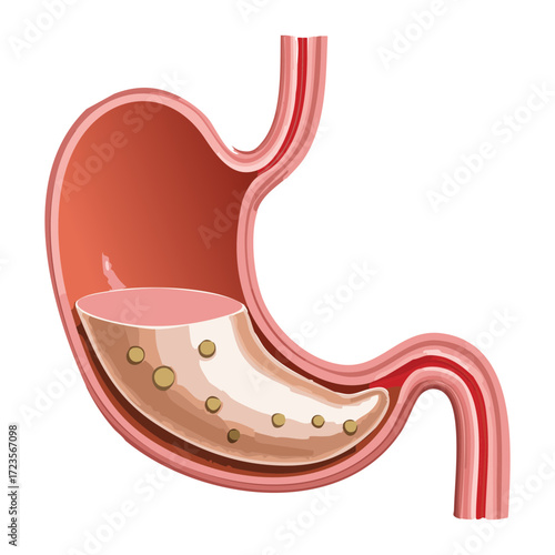 Human Stomach Anatomy Illustrating the Early Stages of Food Digestion with Gastric Juices and Initial Breakdown	