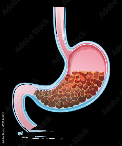 Cutaway view of the human stomach filled with partially digested food particles, representing the early digestion phase	
