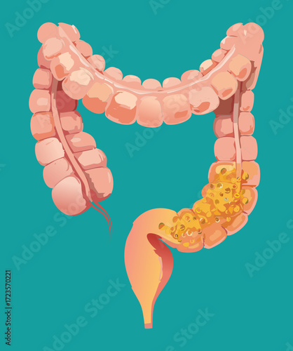 Human Large Intestine and Colon Anatomy with Partial View of the Small Intestine and Appendix Location	