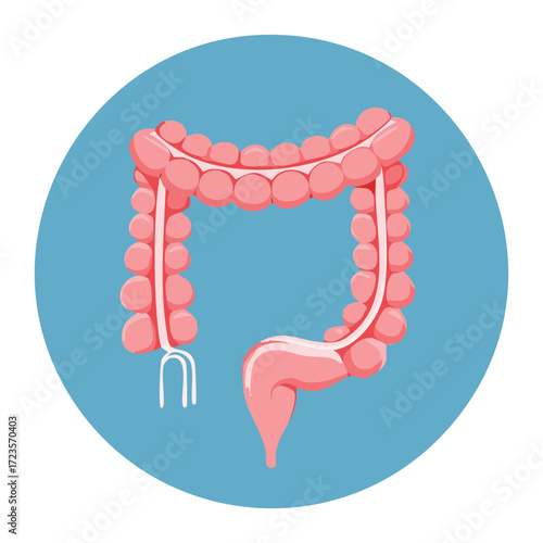 Highly magnified sectional view illustrating the complex tissue layers of the colon wall including the mucosa submucosa and external muscle structures in detail