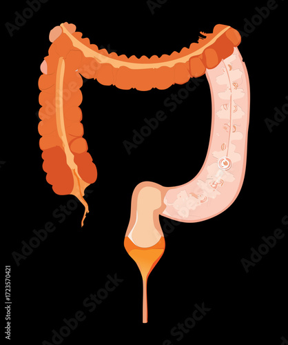 Abstract microscopic image demonstrating the crucial balance of diverse beneficial probiotic bacteria strains populating and protecting the inner surface of a healthy colon