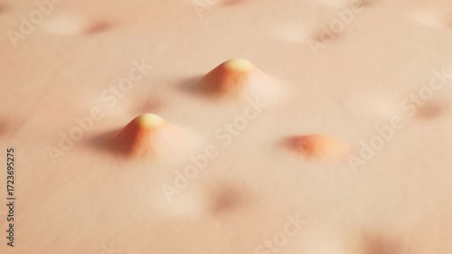 3D animation video of acne pimples forming on human skin, representing skin disease, dermatology issues, pimples, and skincare treatment concept.