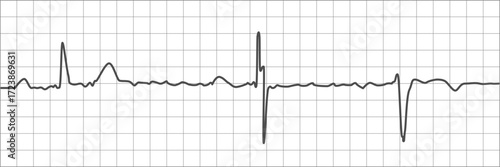 cardiogram