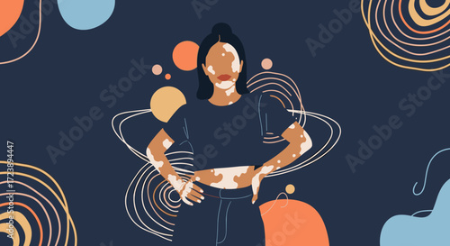 Celebrating diversity and skin positivity with unique beauty and self-acceptance.