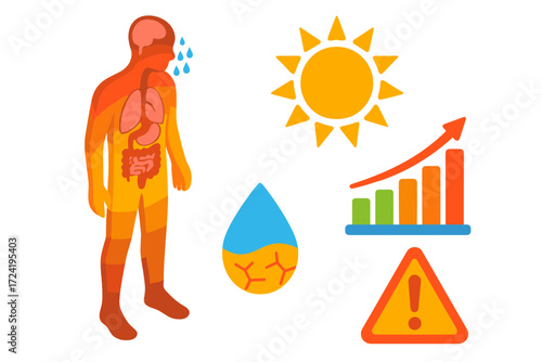 Sun Exposure Stages. Isometric vector illustration set Sun Exposure Infographic: layered human body showing stages of heat