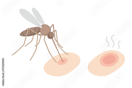 Mosquito Bite Illustration. Isometric vector illustration set mosquito proboscis bite itch: mosquito close-up feeding, needle-like
