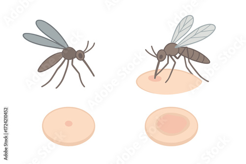 Mosquito Bite Illustration. Isometric vector illustration set mosquito proboscis bite itch: flying mosquito silhouette, proboscis