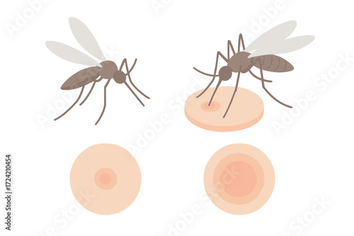 Mosquito Bite Illustration. Isometric vector illustration set mosquito proboscis bite itch: flying mosquito silhouette, proboscis