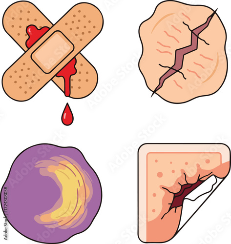 A collection of colorful illustrations depicting various stages of wound healing. 