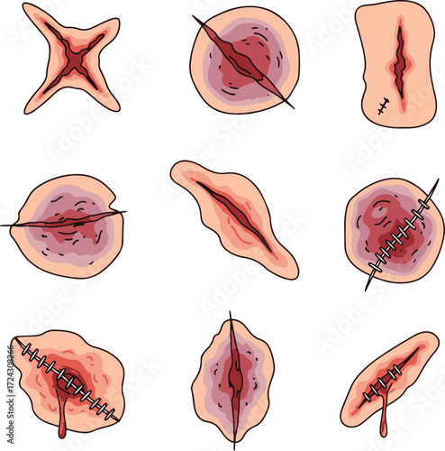 Detailed illustration showcasing various types of wounds, including lacerations, abrasions, and punctures. Each wound is depicted with realistic detail, useful for medical professionals, students, or 