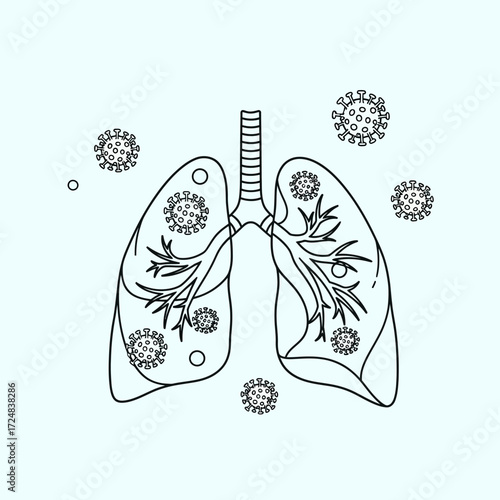 Lungs affected by virus illustration for healthcare awareness