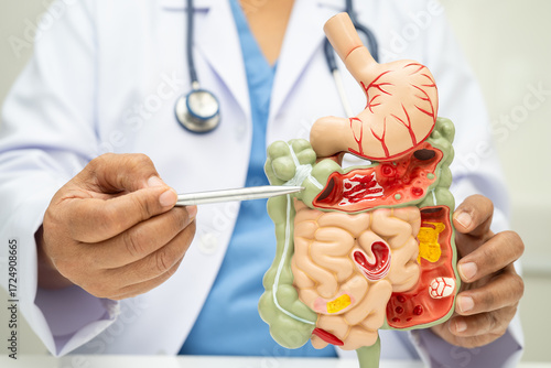 Digestive system with stomach and intestine, Asian doctor holding human anatomy model for study diagnosis and treatment in hospital.