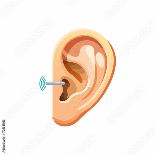 Illustration of Ear with Hearing Aid Inserting into Canal Communicating Clear Sound Wave Signal