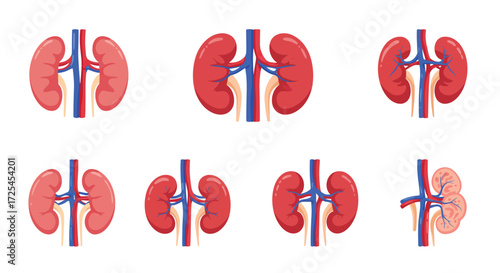 Illustration of human kidneys depicting healthy and diseased states