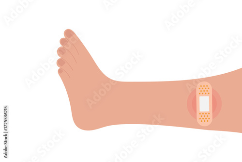 Leg with a bandage. Vector illustration of a leg with a wound, first aid for cuts, abrasions, and injuries