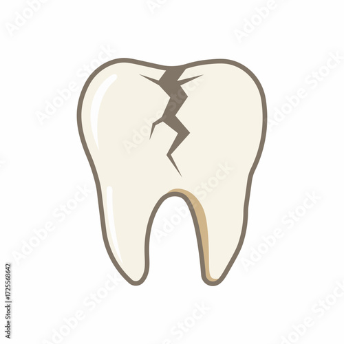 Cracked molar, painful dental emergency.