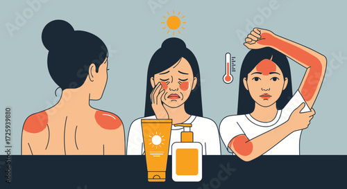 Understanding the Dangers of Sunburn and Effective Prevention Methods for Healthy Skin Protection
