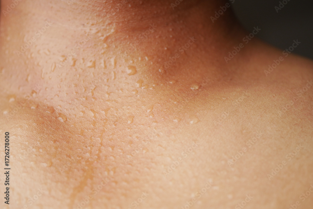 Fototapeta premium Close-up of skin showing beads of sweat during a hot and humid moment