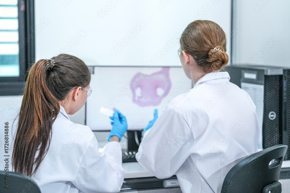 Obraz premium Two pathologists collaborate using a digital pathology workstation. They are comparing a physical glass slide with a whole-slide image WSI for a definitive histopathological diagnosis.