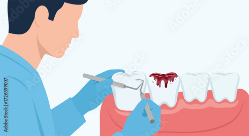 Dental treatment illustration with decayed tooth, tools, and dentist hands in blue gloves. Dental treatment to remove decay in teeth shown with dental treatment and instruments.