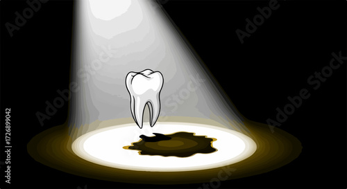 Illustration depicting tooth decay, a molar spotlighted with a dark cavity beneath. Dental health concept highlights importance of preventing tooth decay.