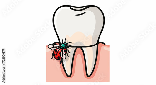 Dental health problems depicted with tooth decay and a small bug. A tooth decay illustration highlights cavities and potential infection, emphasizing dental health problems.