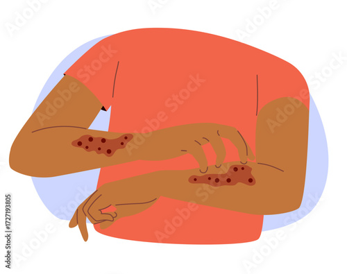 cartoon illustration showing a black ethnicity person scratching arms with eczema skin allergy isolated on white background, representing dermatology, health conditions and medical care