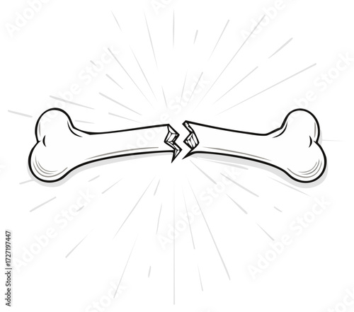 Broken bone illustration graphic, hand drawn style, anatomical concept.