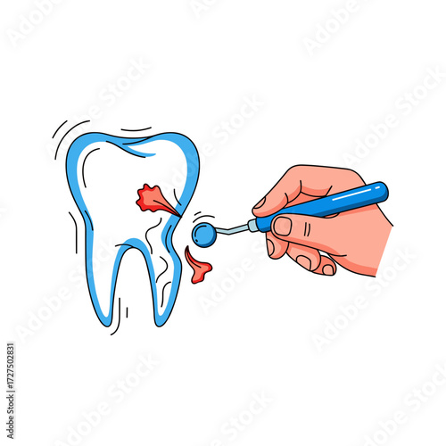 Stylized Dental Examination of a Decayed Molar with a Mirror Tool.