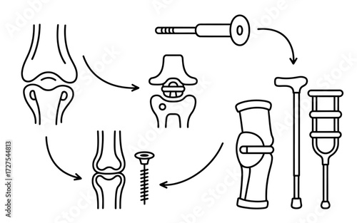 Arthritis Treatment with Joint Replacement and Mobility Aids Featuring Bone Diagrams and Implants Illustration