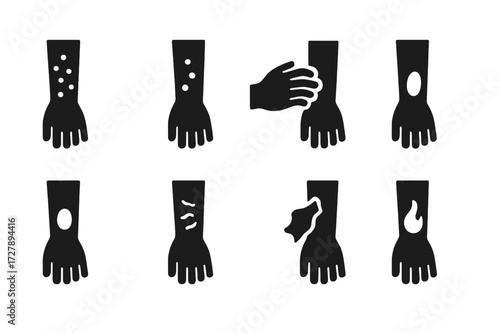 Rash Symptoms Icons. Solid, filled icon set of rash symptoms: red spots, bumps, itching, swelling, blister, dryness, peeling, inflammation. Solid, filled icons