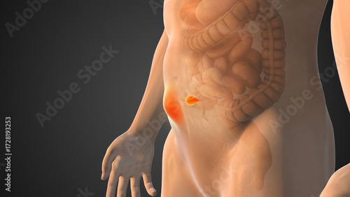 Medical Animation Video of Stomach Hernia Development