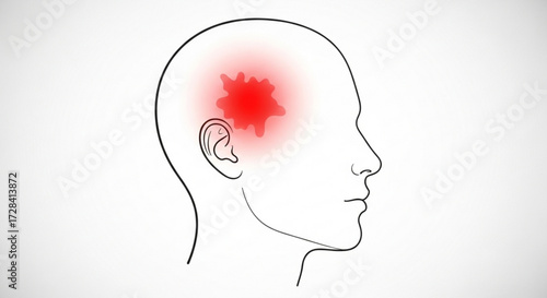 Outline of a head in profile with a red blotch indicating pain or inflammation on the side of the head created with generated ai