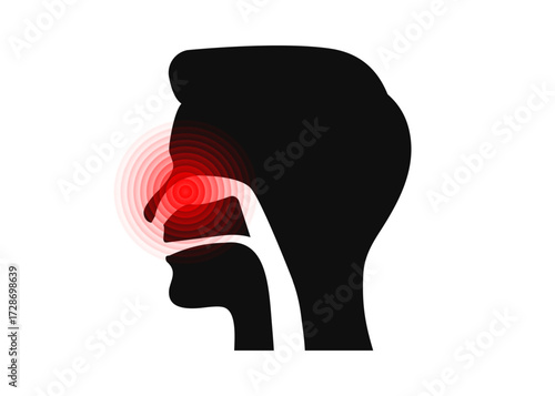 Stuffy nose. Clogged nose due to flu or a viral or bacterial infection. Healthcare. Influenza concept. Isolated vector illustration.