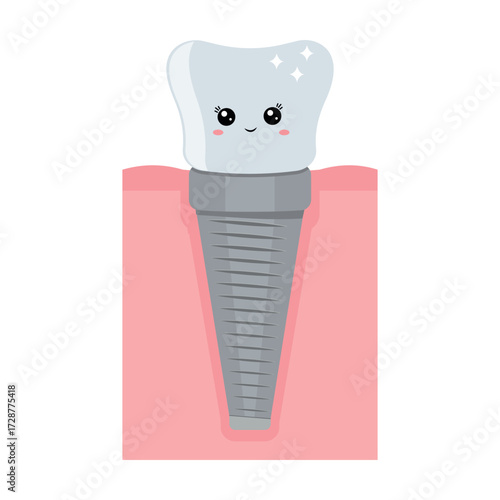 A dental implant, a kawaii character. Screw prosthesis, Illustration of dental implantation,orthodontic dental implantation