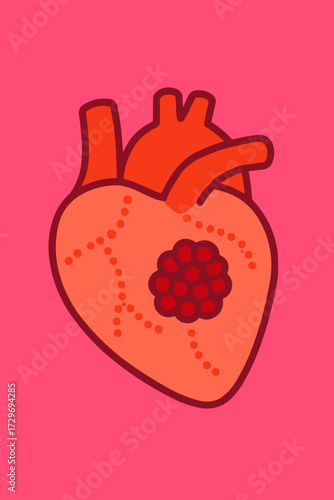 A flat vector illustration of a thrombosis clot in a stylized heart, designed for cardiovascular health campaigns