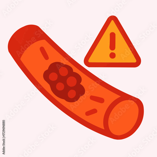 A flat vector illustration of a thrombosis clot with a warning sign, designed for health awareness campaigns
