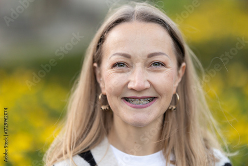 Woman smiling showing dental braces for treatment