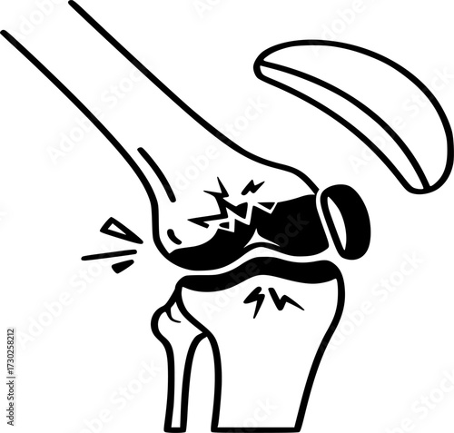broken bone icon solid and line vector. knee joint pain, bone x-ray illustration
