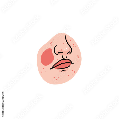 Closeup of red patch on cheek, illustrated facial features  