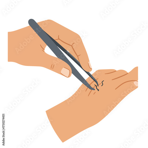 Removing a splinter from a hand with tweezers