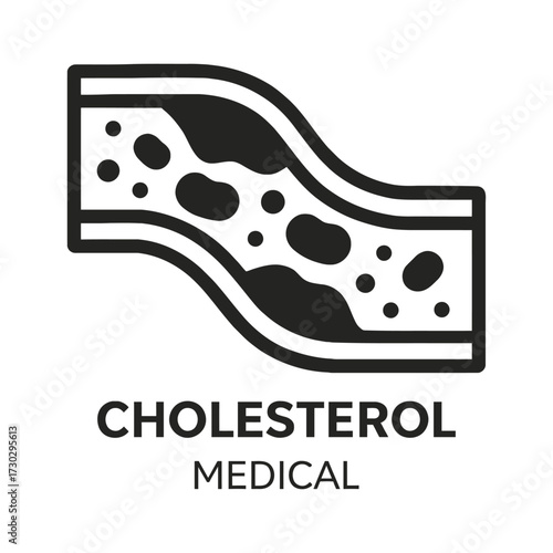 Medical illustration of arterial plaque buildup due to high cholesterol levels