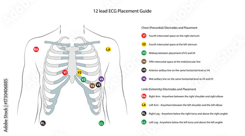 Lanscape electrocardograph placement guide