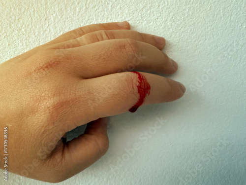 Finger on left human hand was cut by knife during cooking. Blood bleeding with red blood from fresh wound