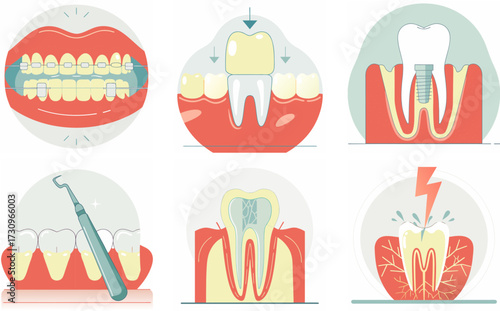 Vector illustration set of dental treatment and oral health icons including braces, tooth implant, crown, dental plaque, root canal, tooth pain and medical care elements for dentistry and healthcare d