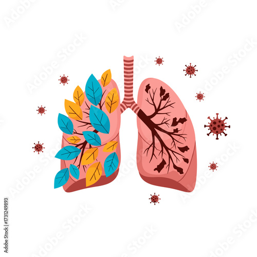 Illustrating the impact of disease on the lungs showing healthy and damaged tissue.