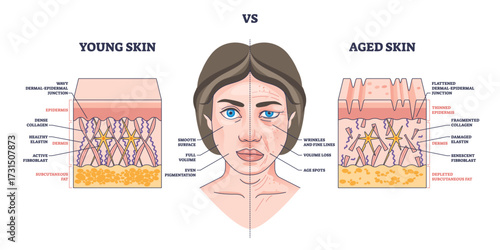 Young vs aged skin shows differences in collagen, elasticity, and wrinkles with labeled skin layers. Outline diagram