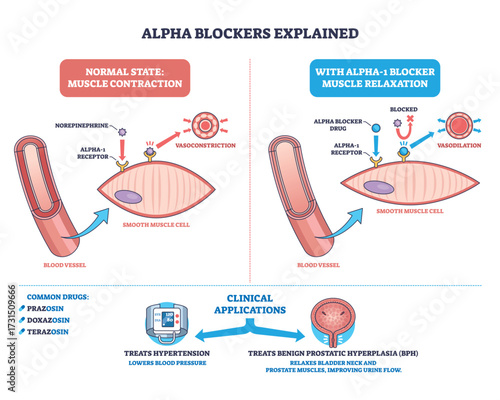 Alpha blockers mechanism diagram shows blood vessel, smooth muscle cell, and receptor interaction for muscle relaxation. Outline diagram